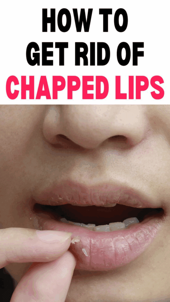 Diy Lip Balm To Revive Dry Chapped Lips Fast 2 Diy Lip Balm To Revive Dry Chapped Lips